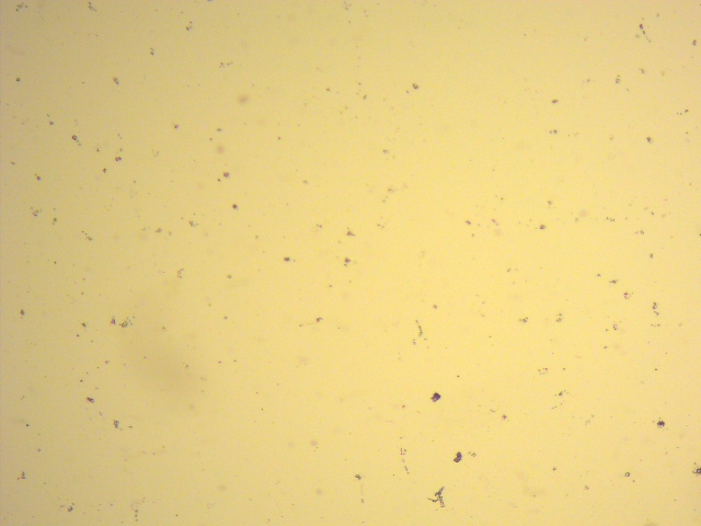 خلايا الطحالب الدقيقة بعد تحلل الخلايا