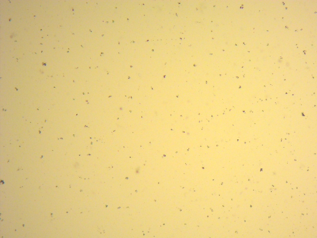 خلايا الطحالب الدقيقة بعد تحلل الخلايا