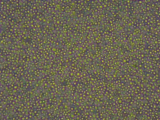 خلايا الخميرة قبل انحلال الخلايا.