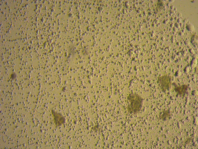 Algae - algal cells before cell lysis