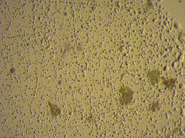 Algae - algal cells before cell lysis