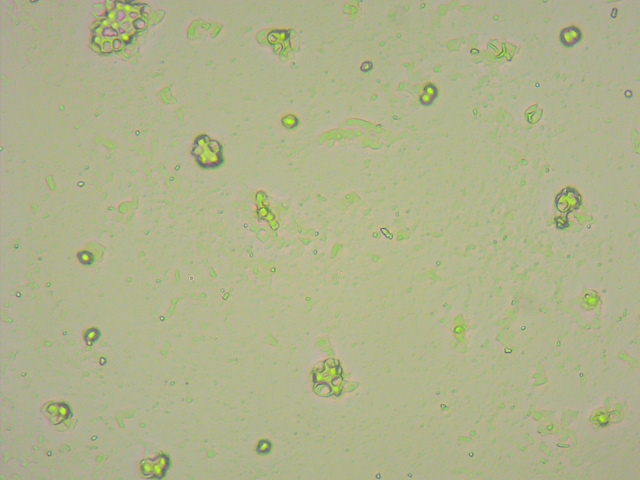 Yeast cells after cell disruption - homogenizer.