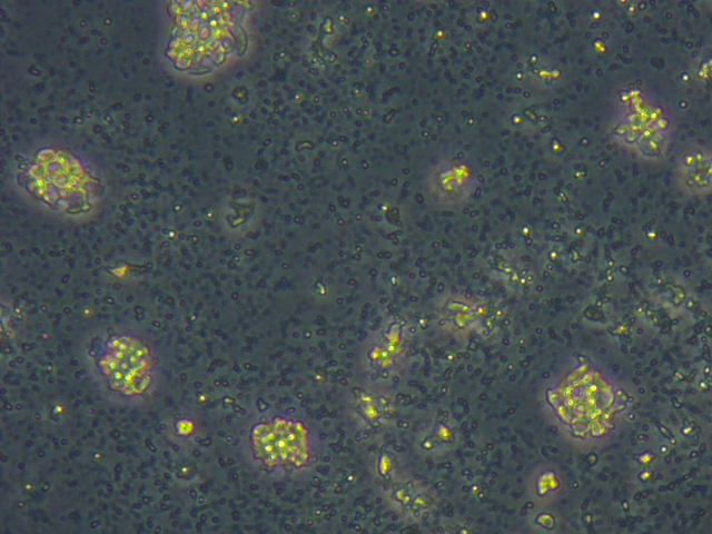 Yeast -  cells after cell lysis - Homogenizer.