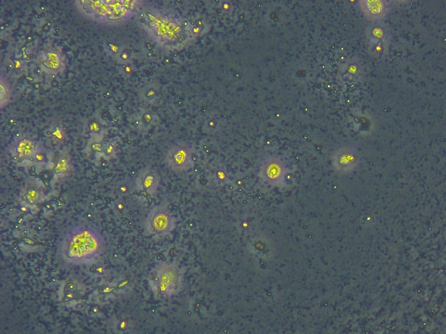 Yeast cells after cell rupture - Homogenizer